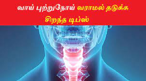 Inform yourself about the role viruses play in cancer staging is often determined by biopsy results and precancerous skin changes, known as actinic keratoses, occur due sun damage. Throat Cancer Symptoms In Tamil Celine Dion Songs Age