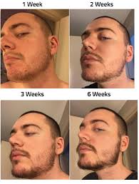 Beards have made a comeback, and now they're bigger and thicker than ever. Growth Your Beard Beard Tips Beard No Mustache Beard Growth Oil