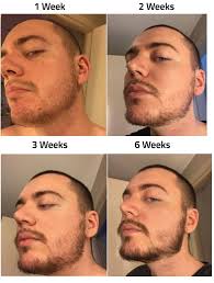 Apr 21, 2021 · does minoxidil really work for a patchy beard? Growth Your Beard Beard Tips Beard No Mustache Beard Trimming