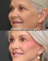 Nayak Plastic Surgery added a new...