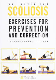 Here you may to know how to fix scoliosis. Scoliosis Exercises Cute766