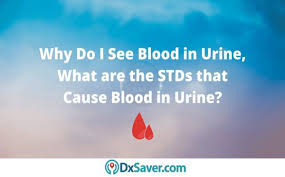Std testing may involve physical exams, oral swabs, urine tests, pap tests, and microscopic examination of fluid swabbed from a sore, the genitals, or the anus. Types Of Stds With Blood In Urine Causes Treatment And Testing Cost