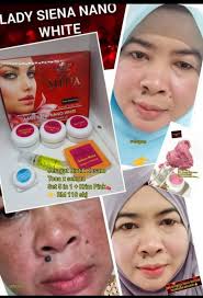 LADY SIENA SKINCARE (LADY SIENA NANO WHITE): 2020