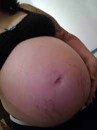 Bauch kommt bestimmt noch und randale vielleicht auch! 16 Ssw Kein Babybauch Normal Forum Schwangerschaft Urbia De