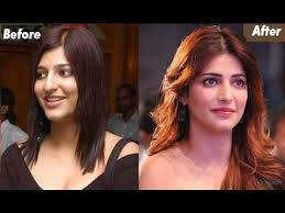 Facetouchup is the premier tool for visualizing plastic surgery results. 10 Bollywood Actresses Who Underwent A Nose Job To Look Gorgeous Mr Lanfill Youtube