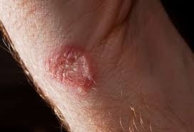 Skin Health The Creatures That Live On Your Body