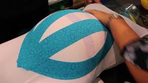 After 34 weeks of pregnancy, taping could limit the baby's positioning, so be cautious if the baby is in the breech posterior (back to back) position. Kinesiology Taping Techniques For Pregnancy Youtube