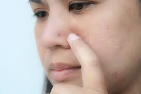 How To Care For Your Nose Piercing Nose Piercing Facial Piercings Piercing