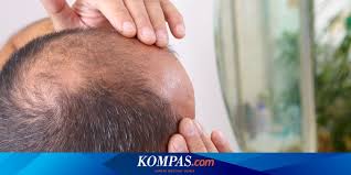 Beberapa misteri ini memang sudah terjawab oleh sains, tetapi terkadang hal itu masih menimbulkan pertanyaan. Misteri Tubuh Manusia Kenapa Kebotakan Pria Dimulai Dari Atas Kepala Aka Pulsa Isi Pulsa Kuota Online Terpercaya