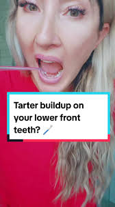 Most of us build up tartar