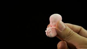 Seit vier jahren unterstützt und berät sie über eine hotline telefonisch frauen, die trotz des verbotes eine abtreibung zu hause oder im ausland durchführen. Tabuthema Abtreibung Panorama