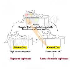 Image result for Thomas Test