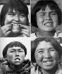 Diseases Deriving from Alterations of the Ecological Niche—Part I: Not  Regarding the Holobiont