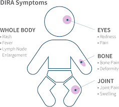 They fit into small places and have ample kitchen worktop space and kitchen storage. Kineret Anakinra Official Website Home