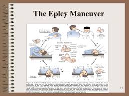 Lie down on your back, turn head to left for 1 minute 2. Ppt Benign Positional Vertigo Powerpoint Presentation Free Download Id 214731