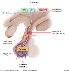 Image result for Hyperprolactinemia