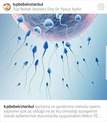 How to stop smelling like fish. What Does Sperm Smell Like Is It Normal To Have Strong Odor