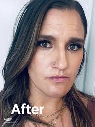 Lip Blushing Before and After: Real Results of Semi-Permanent Lip  Enhancement