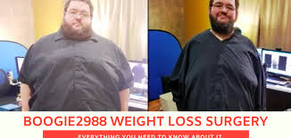 Boogie2988 is a american youtuber from arkansas, united states. Boogie2988 Weight Loss Surgery Everything You Need To Know About It
