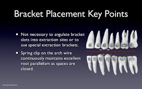 Speed Bracket Placement Guide V2012