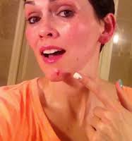 kandeej.com: The Emergency Hide A Zit Trick