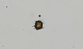 Urine Crystals In Dogs Cats Urinarios Cristales Sedimentarias