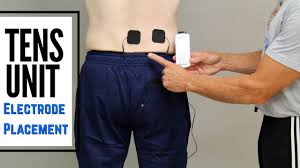 Tens Unit For Low Back And Sciatic Pain Electrode Placement Youtube