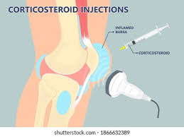 Image result for Scapulothoracic Injection