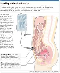 The straits times also has an online presence at www.straitstimes.com. The Straits Times News Feature Download Scientific Diagram