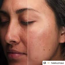 Ready for your best skin ever? Get that holiday glow