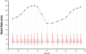 Normal fetal heart rate exhibits fluctuations of approximately 6 to 25 beats/minute (see fig. Chapter 03 Heart Rate Variability Heartmath Institute