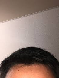 Rub natural oil into the middle and ends of your hair to make it soft and supple. How To Get Rid Of Small Thin Hairs My Barber Cut My Hair With Scissors Then Little Thin Hair Strands Came Up Can A Barber Cut Them Off Or Should I Cut