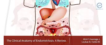 Carlo bulletti, maria elisabetta coccia, silvia battistoni. Endometriosis A Review On Anatomic Principles And The Management Endonews