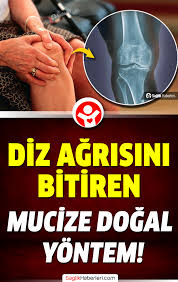 Diz Agrisi Nasil Gecer Diz Agrisi Icin 8 Dogal Ev Caresi Dogal Saglik Egzersiz Motivasyon