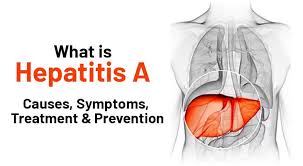 Image result for hepatitis symptoms