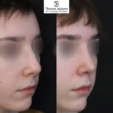 Thomas Jacques (@mrthomasjacques) · London