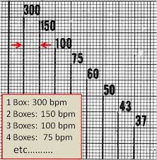 Ecg Learning Center An Introduction To Clinical