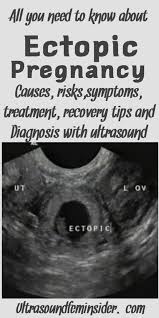 Pin On Informed Pregnancy