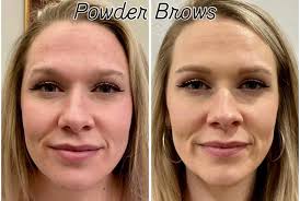 Bellezza Laser Aesthetics (@bellezzaladies) • Instagram photos and videos