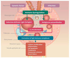 Recent international collaborative efforts have led to important discoveries that have improved our understanding of some of the key steps involved in the immunopathogenesis of igan. Jcm Free Full Text The Emerging Role Of Pathogenesis Of Iga Nephropathy Html