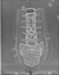 SERVICE DELIVERY AND INNVOATION POSTER PRESENTATIONS