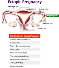 Pin On Gynecology