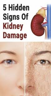 5 Hidden Signs Of Kidney Damage Diet Kidney Damage Cancer Health Tips