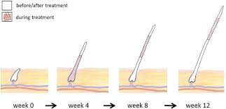 Keeping your hair as healthy as you can is the key to longer hair. Hair Growth Model Of Natural Unshaved Hair In The Anagen Phase During Download Scientific Diagram