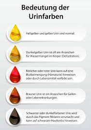Zu den ursachen von blut im urin bei der frau zählen: Dunkler Urin Ursachen Diagnose Behandlungen