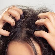 Hair dye and bleach haven't been scientifically proven to kill lice. Does Hair Dye Kill Lice How To Get Rid Of Lice Using Hair Color