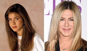 Biggest & most modern plastic surgery clinic in baltic states, team of 6 plastic surgeons Rhinoplasty Before And After Which Celebs Have Had Nose Jobs From Jennifer Aniston To James Argent