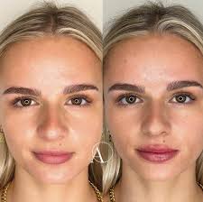Amirova Cosmetic Clinic | Skin Clinic Neutral Bay Sydney