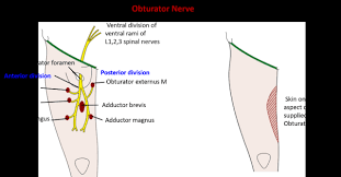 Image result for Obturator Nerve Compression