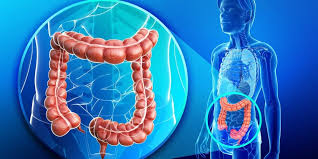 Hotels in colón, costa rica. Colon Cancer Symptoms Causes Treatment Dr Nikhil Agrawal